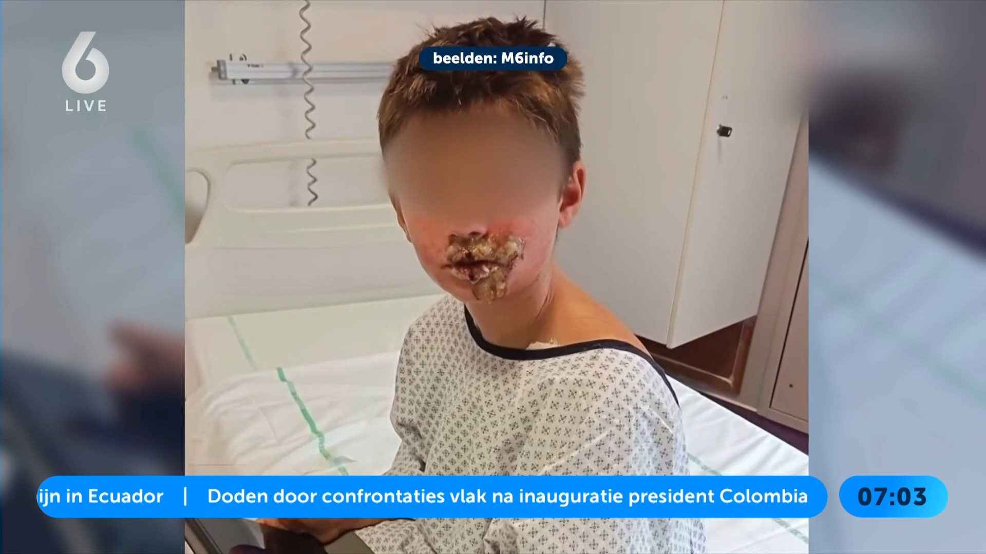 Frankrijk onderzoekt squishy die ontplofte in gezicht jongen (8)